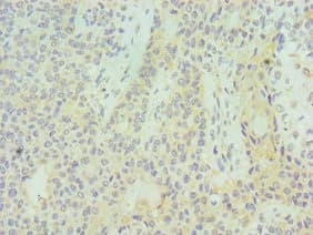 SUV39H2 Antibody (aa201-410)