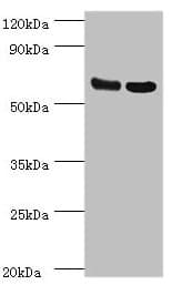 Polyclonal Rabbit anti-Human PDPK1 / PDK1 Antibody (aa277-556, IHC, WB)