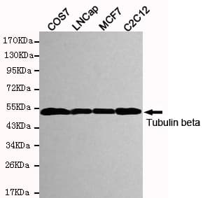 TUBB / Beta Tubulin Antibody