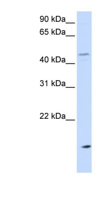 Polyclonal Rabbit anti-Human CETP Antibody (aa36-85, WB)