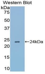 APRT Antibody (aa1-180, HRP)