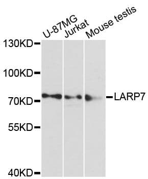 Polyclonal Rabbit anti-Human LARP7 Antibody (WB)
