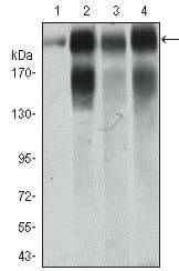 ITGB4 / Integrin Beta 4 Antibody (Amino Acid: 1619-1822, clone 10B10D5)