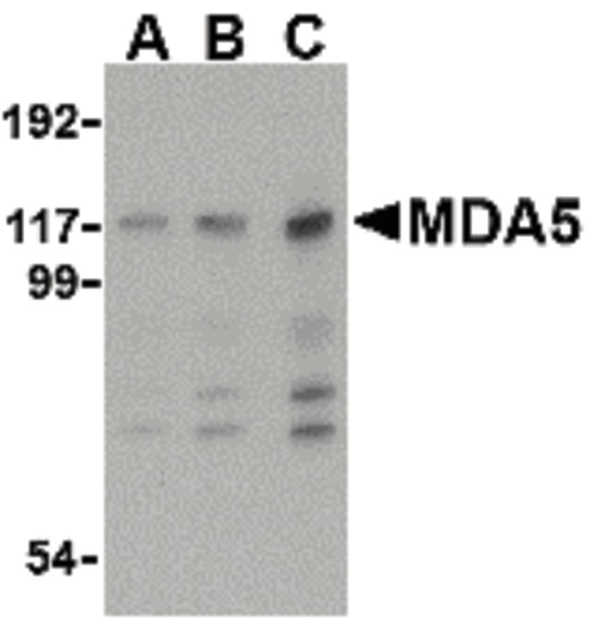 IHC-plus™ IFIH1 / MDA5 Antibody