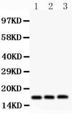 Polyclonal Rabbit anti-Human FHIT Antibody (aa1-147, IHC, WB)