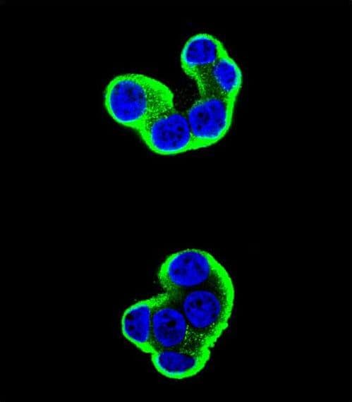 IHC-plus™ Monoclonal Mouse anti-Human SDC1 / Syndecan 1 / CD138 Antibody (aa210-238, IHC, IF, WB)