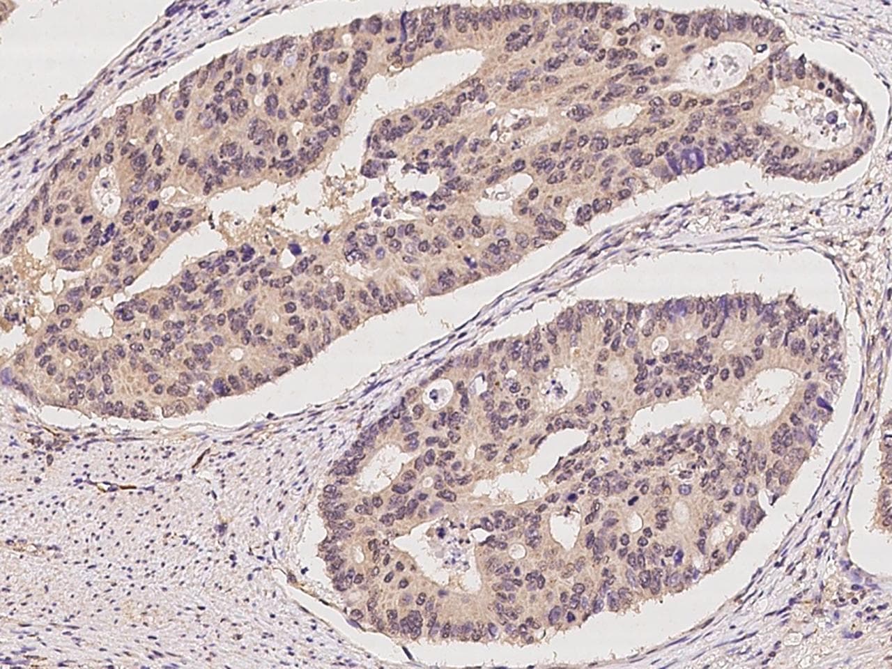 UBTD2 Antibody