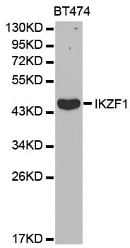 IHC-plus™ Polyclonal Rabbit anti-Human IKZF1 / IKAROS Antibody (IHC, IF, WB)