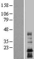 LAPTM4A Protein (Over-Expression Lysate Myc-DDK (Flag))