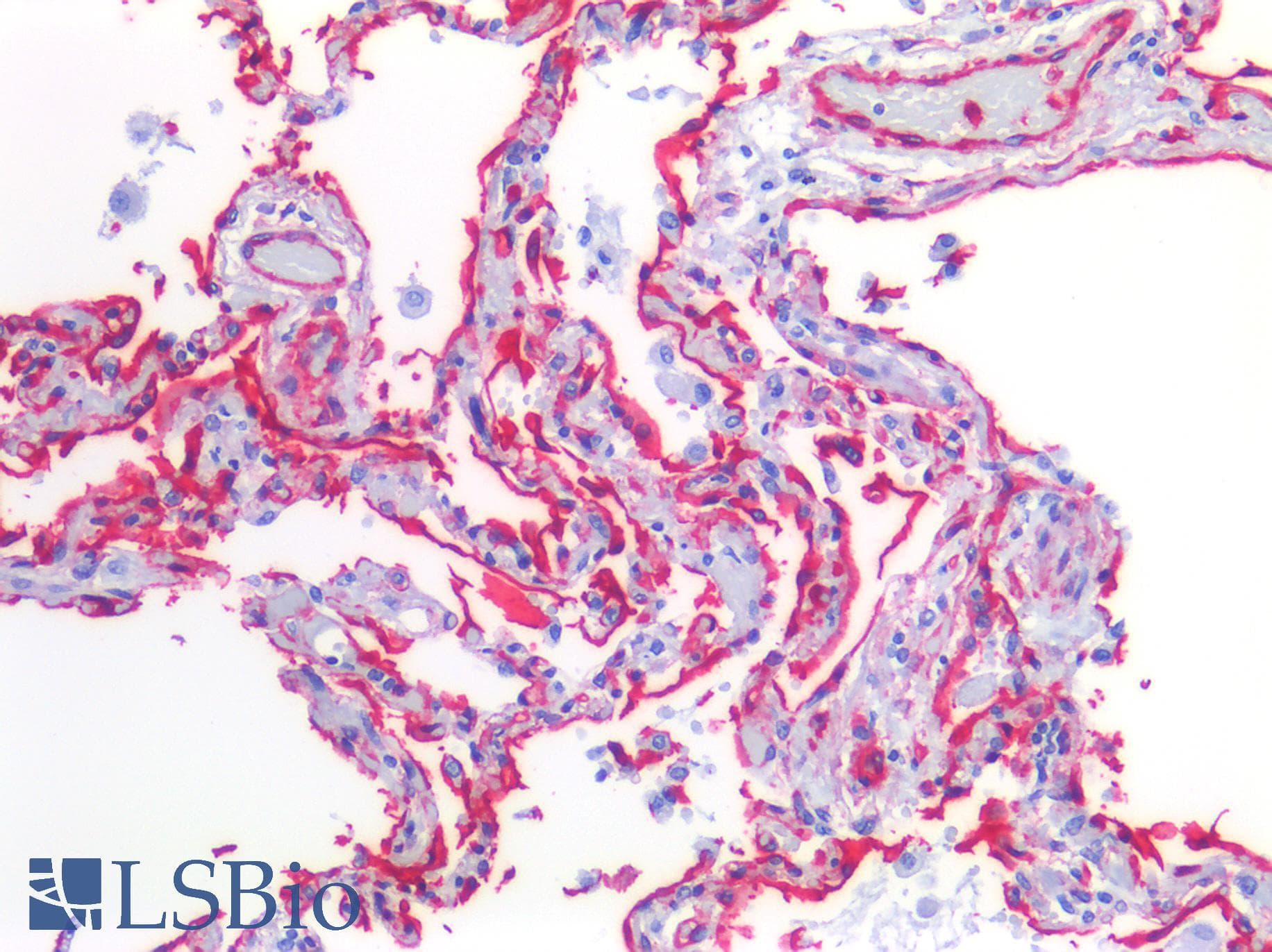 IHC-plus™ CAV1 / Caveolin 1 Antibody (C-Terminus)
