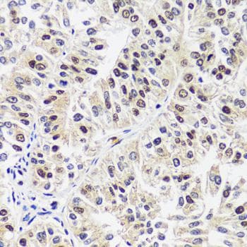 TIP120 / CAND1 Antibody