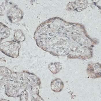 Polyclonal Rabbit anti-Human GPR78 Antibody (IHC)