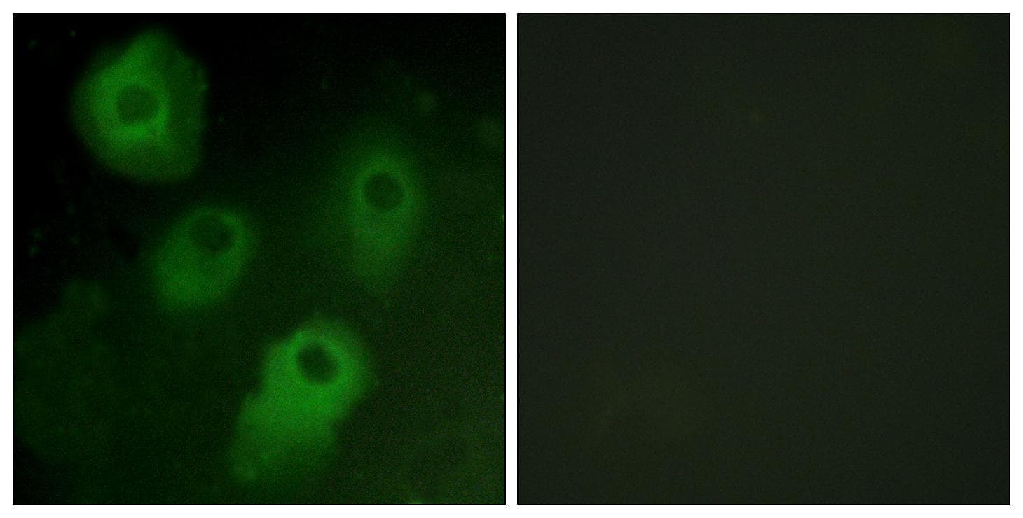 PRKCD / PKC-Delta Antibody (Ab-52)