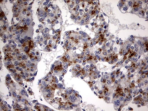 CSNK1G2 / CKI-Gamma 2 Antibody (aa163-415, clone OTI4H3)