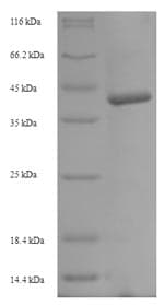 Barley EPB2 Protein (Recombinant 6His-SUMO, N-terminus)