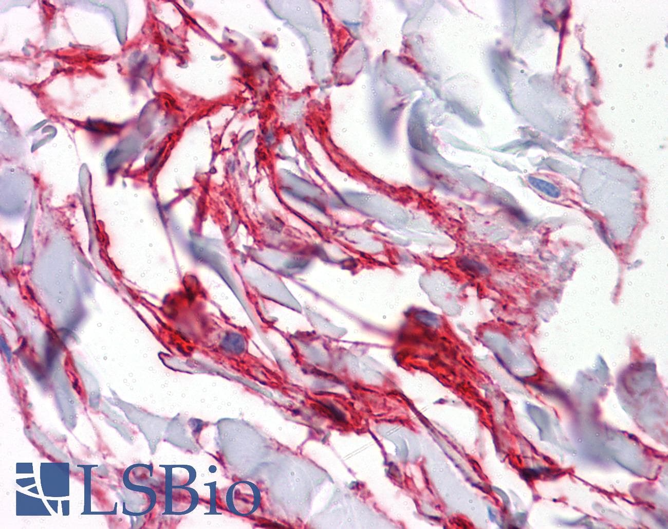 IHC-plus™ Monoclonal Mouse anti-Human AQP8 / Aquaporin 8 Antibody (clone 1F8, IHC, WB)