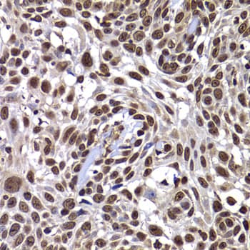 Polyclonal Rabbit anti-Human DNAJB6 Antibody (IHC, IF, WB)