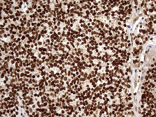 DDX19A Antibody (clone OTI3C12)