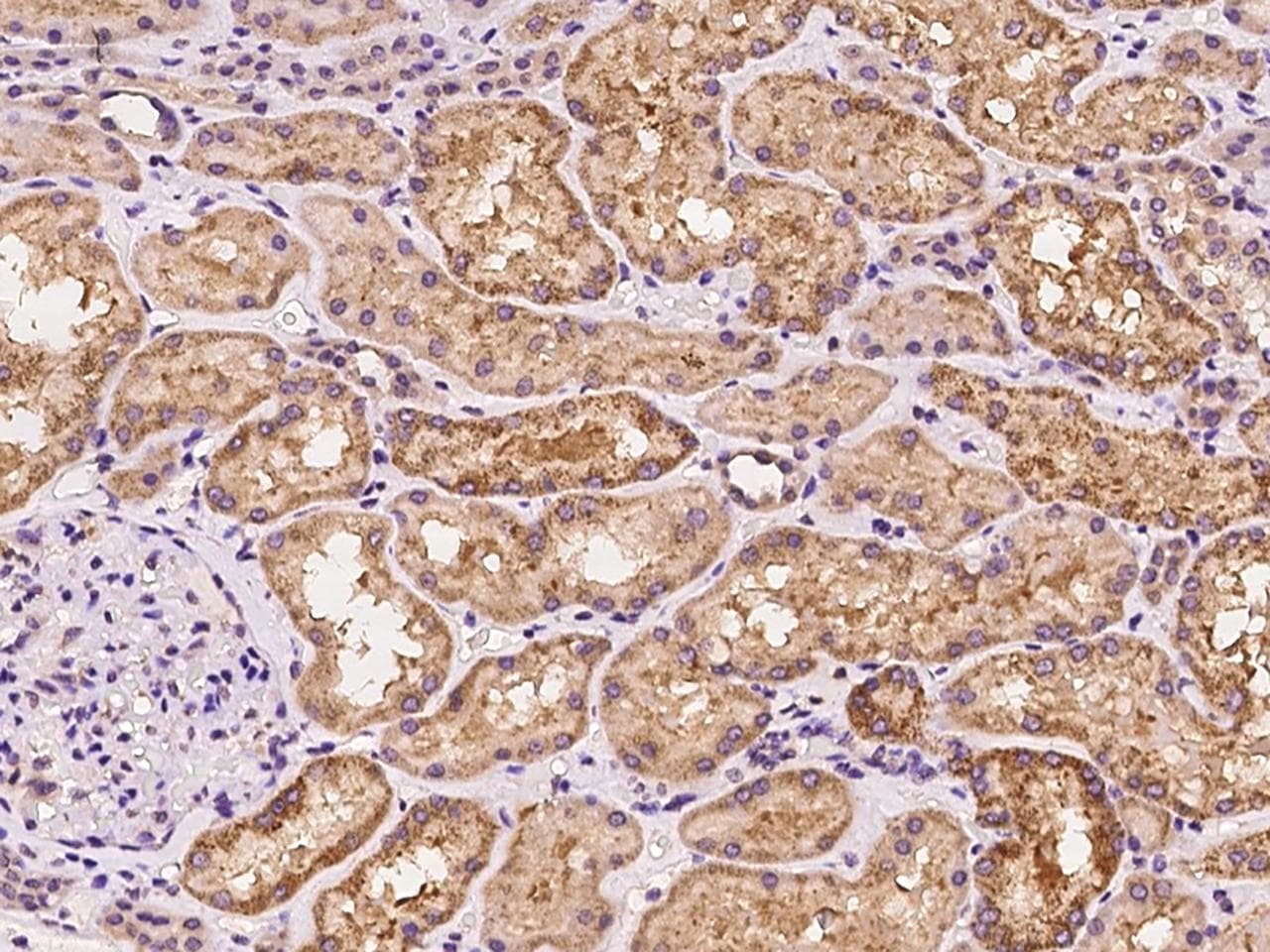 YARS / Tyrosyl-tRNA Synthetase Antibody