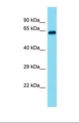 ACSM3 / SAH Antibody (aa346-394)