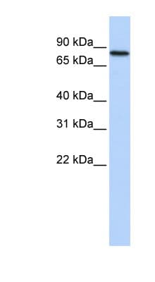 RED2 / ADARB2 Antibody (aa612-661)