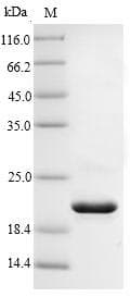Human IL18 Protein (Recombinant 6His, N-terminus)