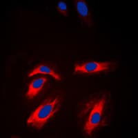 CKM / Creatine Kinase MM Antibody (N-Terminus)