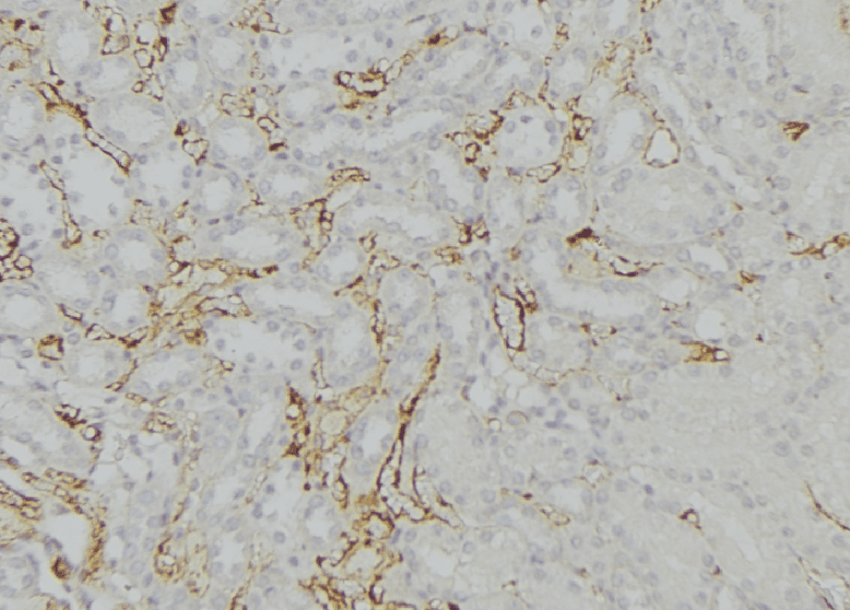 KDELR1 / HDEL Antibody