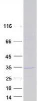 Human KCTD21 Protein (Recombinant Myc-DDK (Flag))