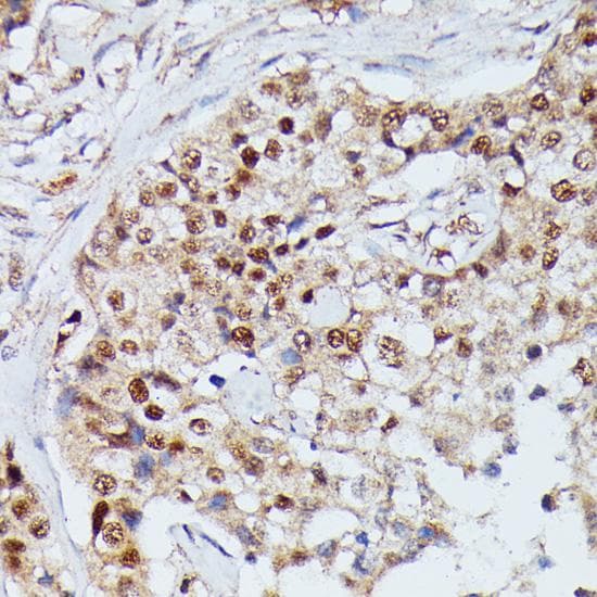 Polyclonal Rabbit anti-Human IGHMBP2 Antibody (IHC)