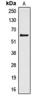 IHC-plus™ CYP4Z1 Antibody (Internal)