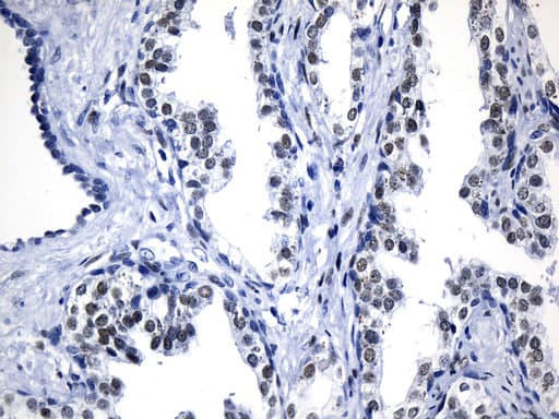 AR / Androgen Receptor Antibody (aa420-659, clone UMAB240)