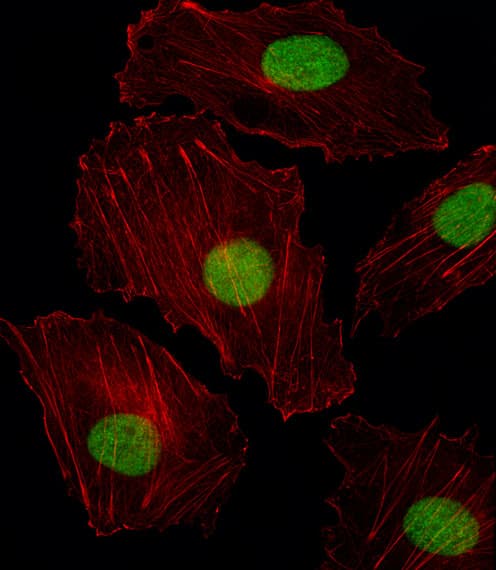 Polyclonal Rabbit anti-Human ISL2 / Islet 2 Antibody (aa1-30, IF, WB)