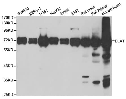 DLAT / PDC-E2 Antibody