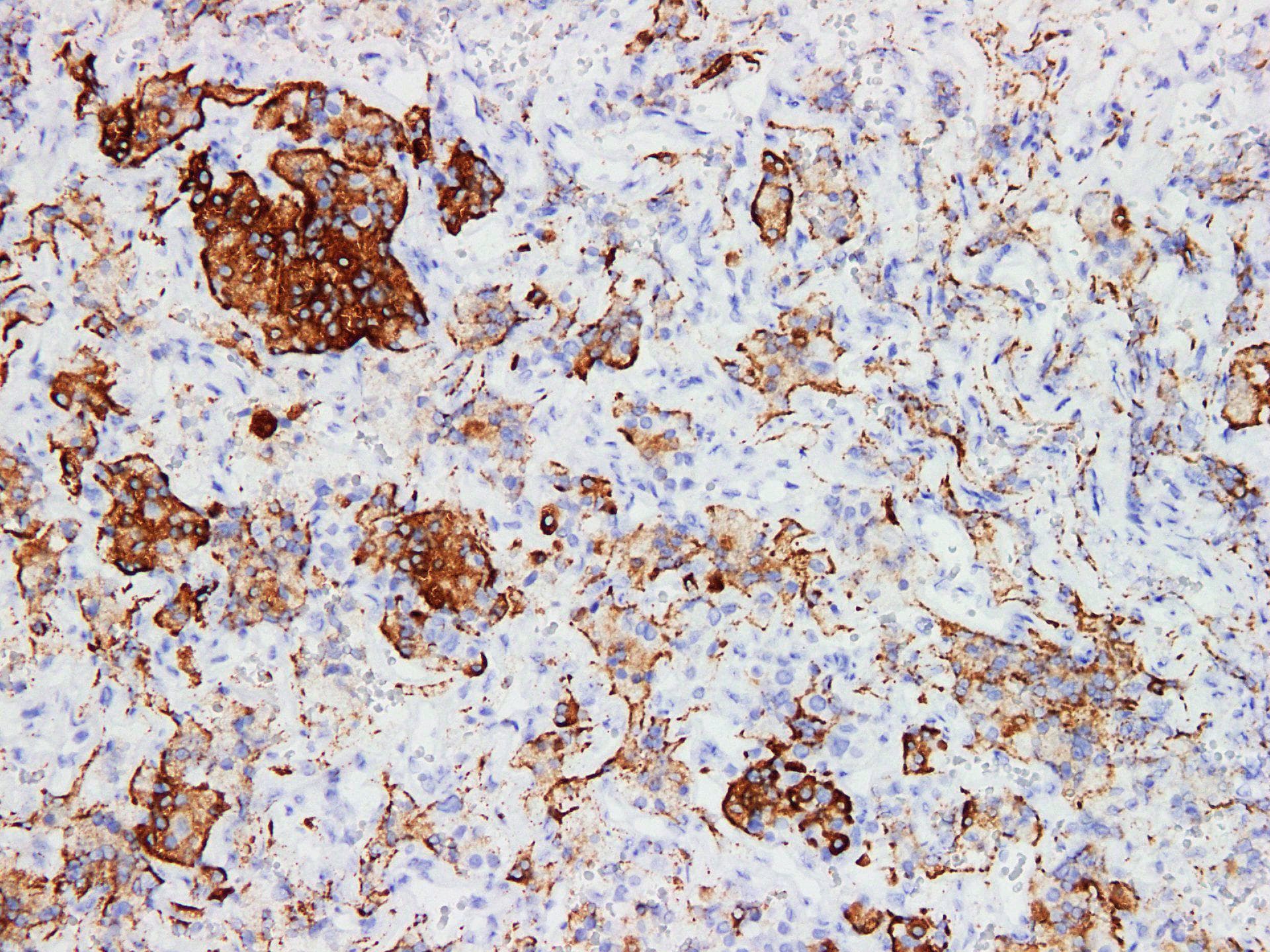 Monoclonal Mouse anti-Human GH / Growth Hormone Antibody (IHC)