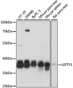 LEFTYB / LEFTY1 Antibody