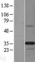 PPAPDC2 Protein (Over-Expression Lysate Myc-DDK (Flag))