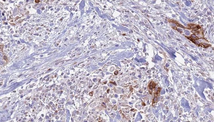 ITGA2B / CD41 Antibody