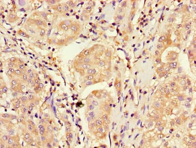 Polyclonal Rabbit anti-Human CDKN2B / p15 INK4b Antibody