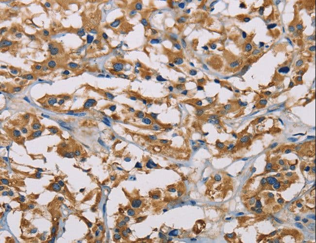 Polyclonal Rabbit anti-Human PIP4K2A / PIPK Antibody (IHC, WB)