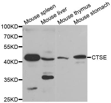 Polyclonal Rabbit anti-Human CTSE / Cathepsin E Antibody (IHC, IF, WB)