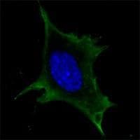 Monoclonal Mouse anti-Human CALR / Calreticulin Antibody (clone 1G6A7, aa405-417, IHC, IF, WB)