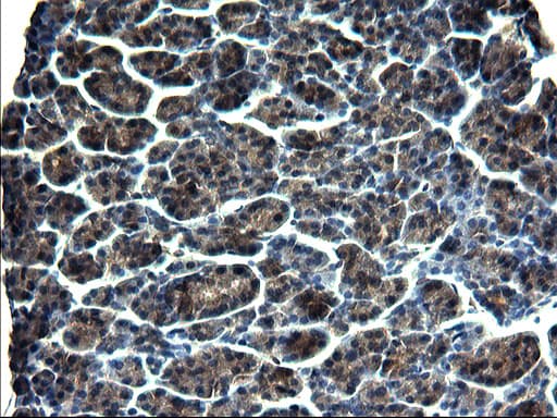 GCLC Antibody (clone OTI1A3)