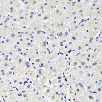 DNMT / DNMT1 Antibody