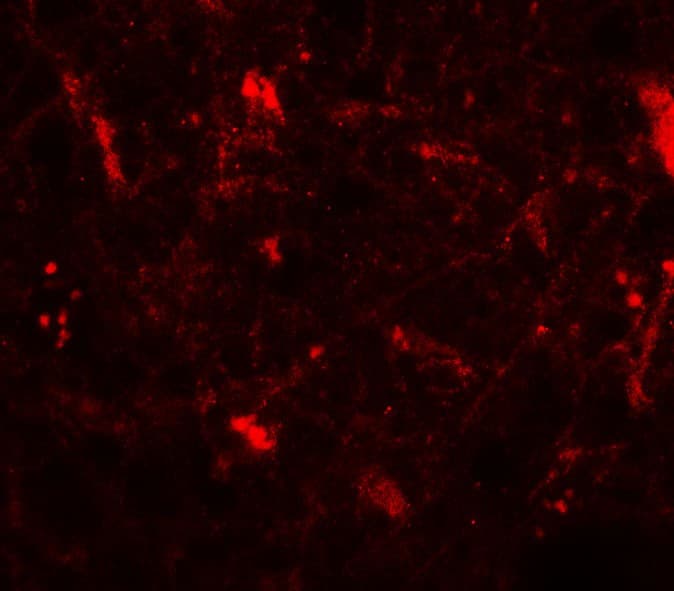 CRH / CRF Antibody