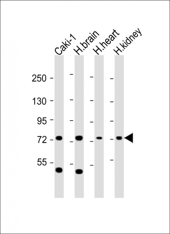 Polyclonal Rabbit anti-Human RNF139 / TRC8 Antibody (aa604-636, WB)
