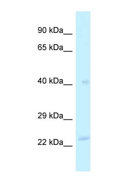 MRPL40 Antibody (aa90-139)