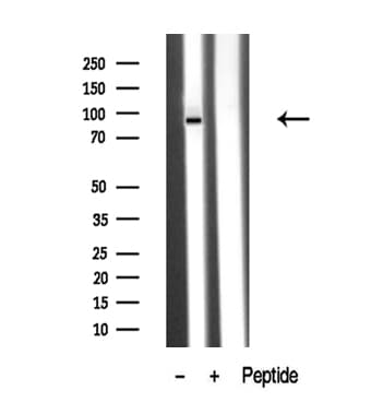 Polyclonal Rabbit anti-Human PKD2 / Polycystin 2 Antibody (WB)