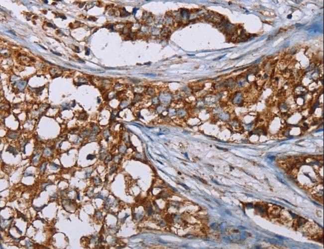 BMP6 Antibody