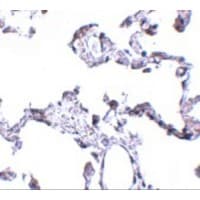 Polyclonal Rabbit anti-Human CD81 Antibody (IHC, IF, WB)
